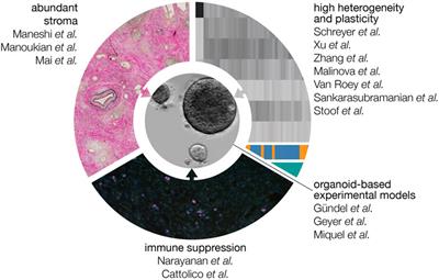 Editorial: Translational Insights Into Pancreatic Ductal Adenocarcinoma